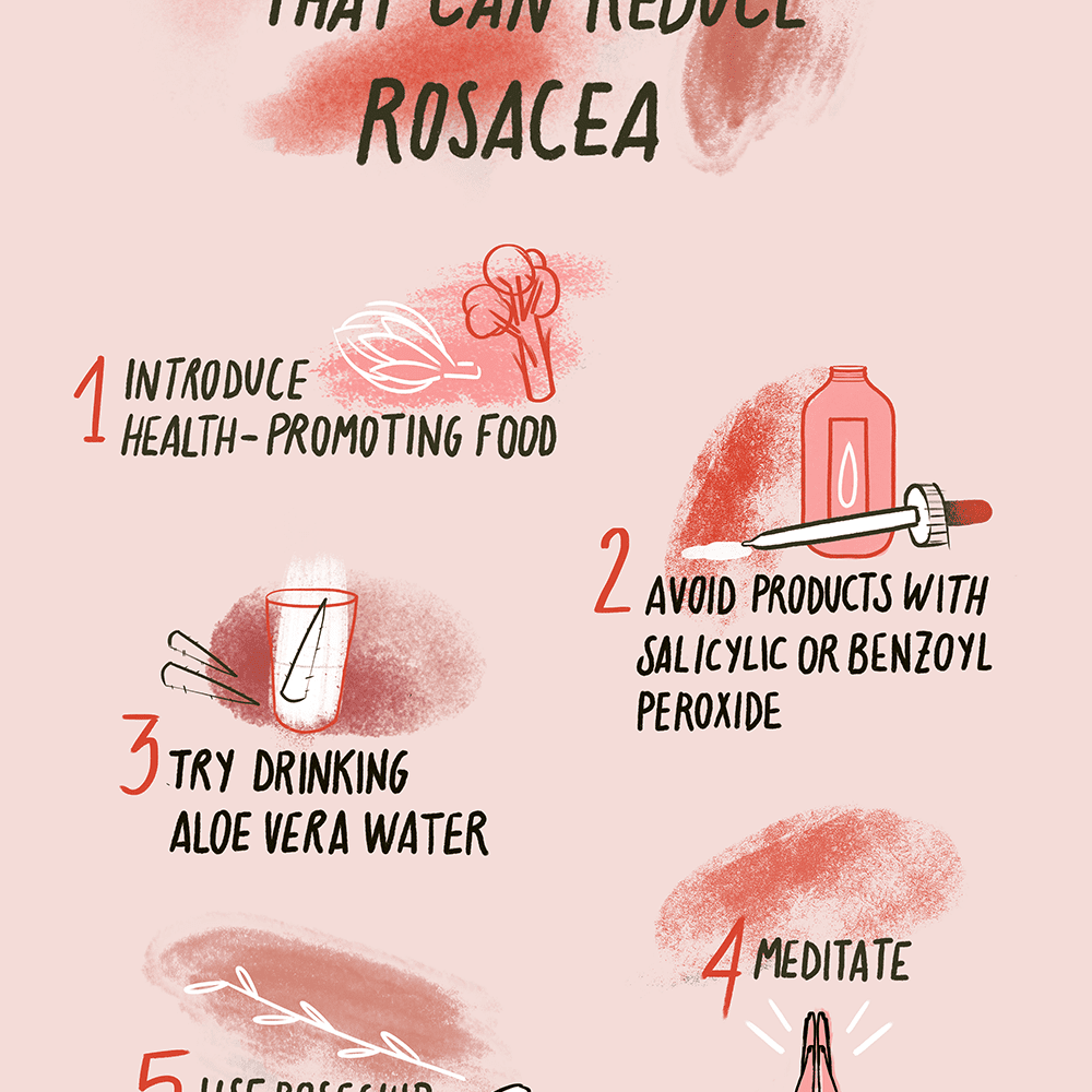 best natural treatment for rosacea.