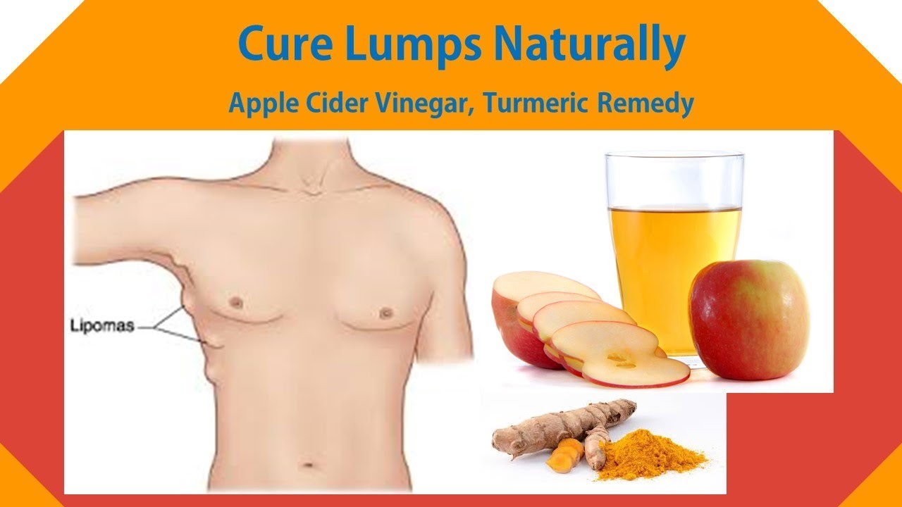 apple cider vinegar lipoma turmeric and chickweed salve