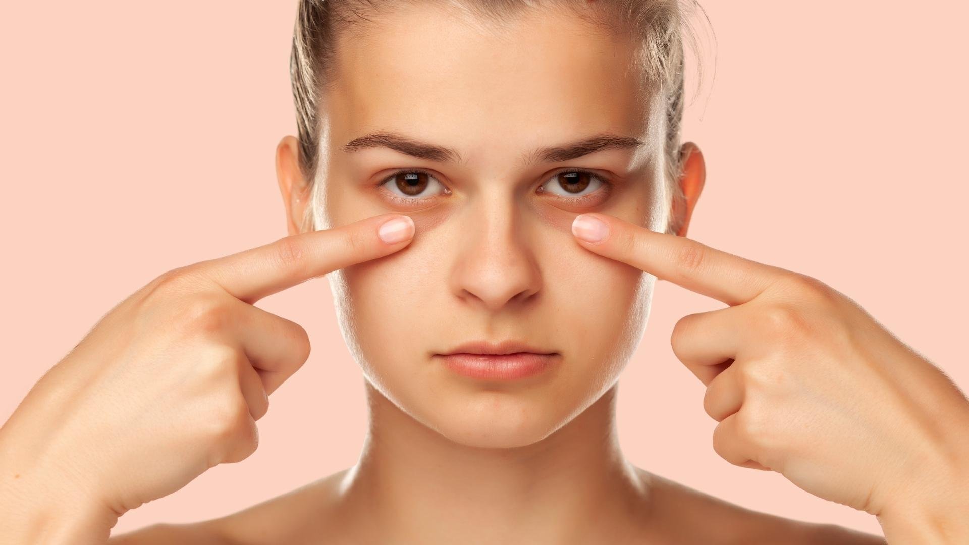 Eyes Brown Spot in Your Eye