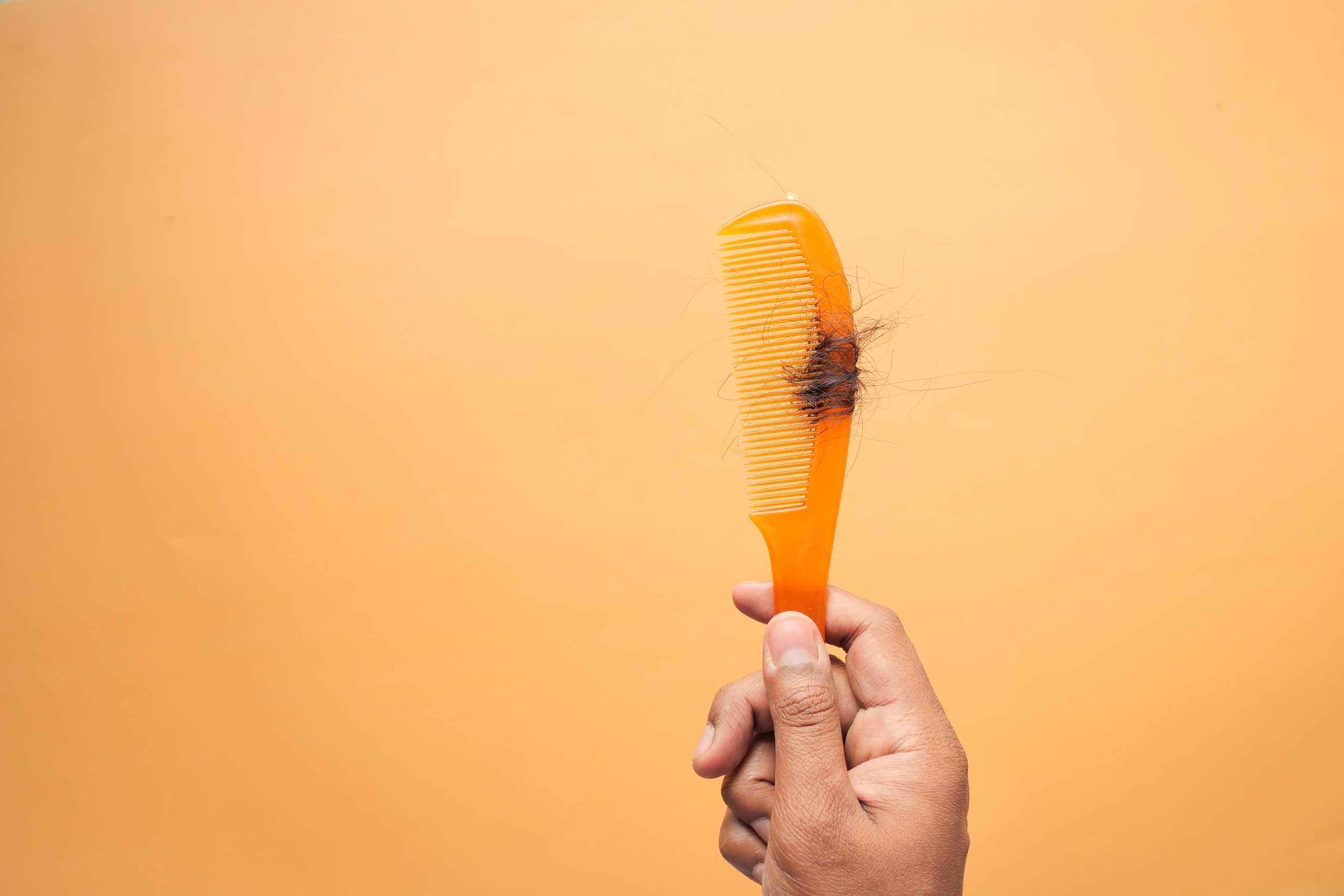 Close-up of a hand holding a comb with loose hair strands, illustrating increased hair shedding.